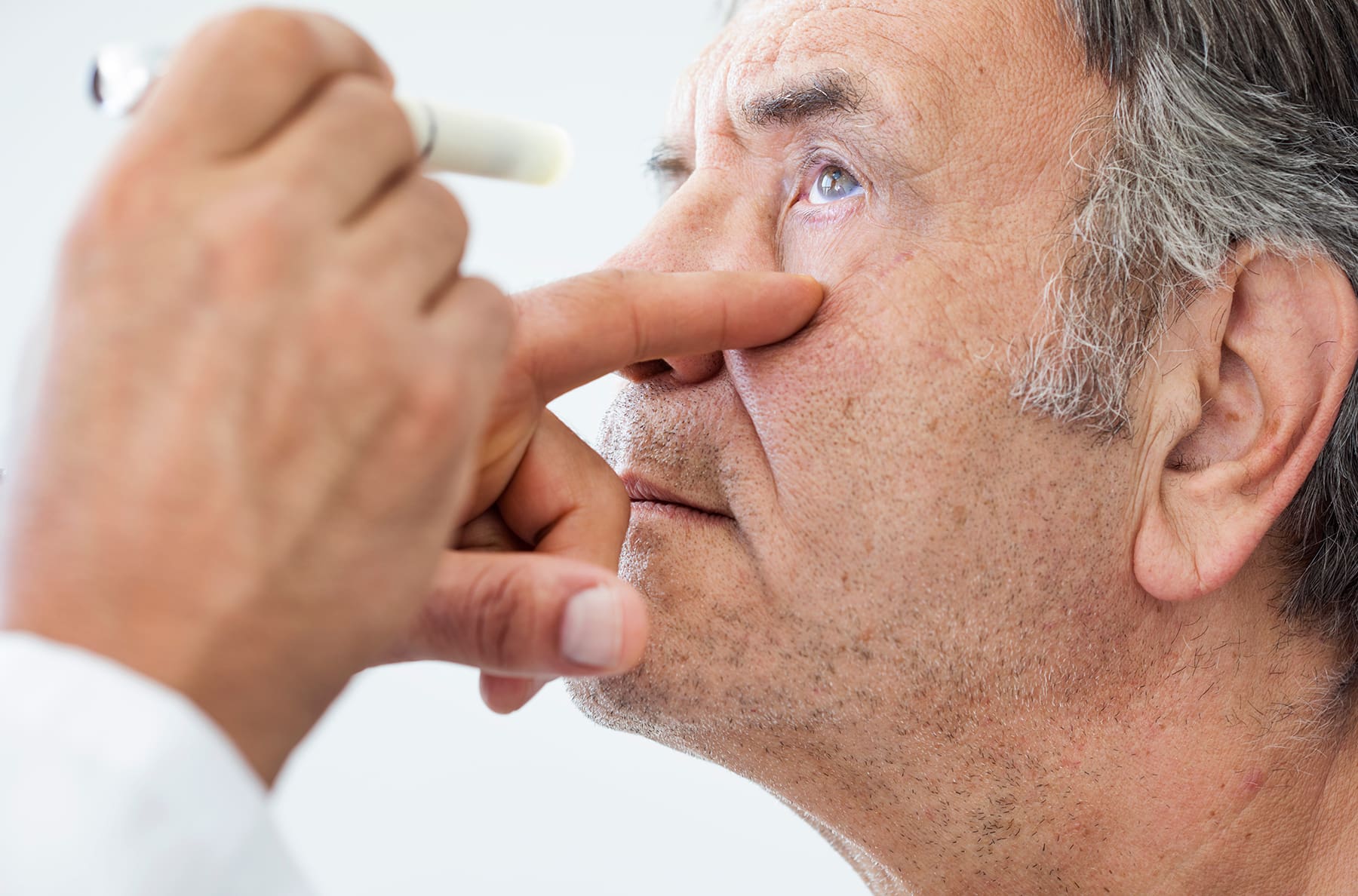 Cataracts Explained: Causes, Symptoms, and Treatment